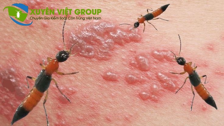 Dịch vụ diệt kiến tại Hà Nội, xử lý triệt kể kiến đen, kiến ba khoang, kiến hôi...
