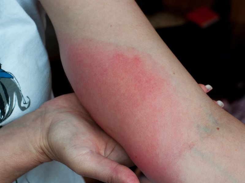 Tự bắt ong tại nhà có thể bị ong tấn công